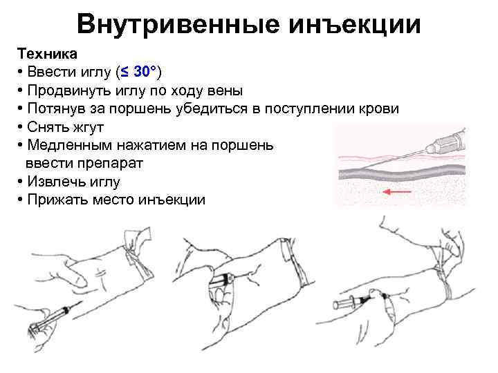 Внутривенные инъекции презентация