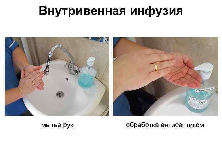 Внутривенная инфузия мытье рук обработка антисептиком 