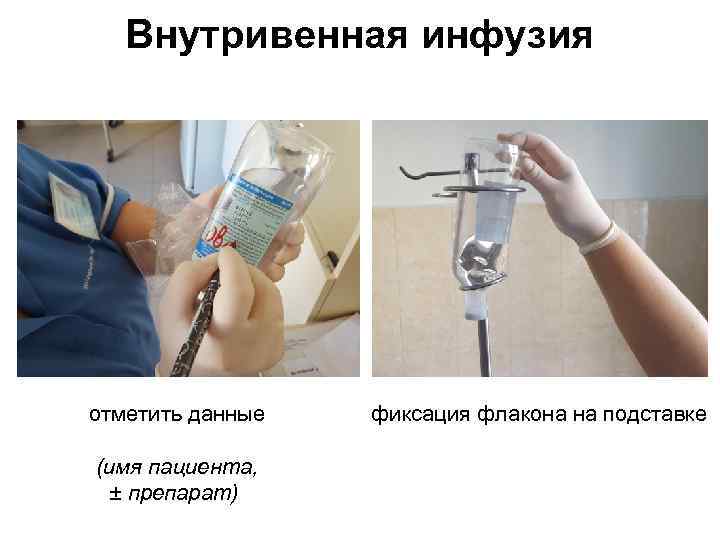 Внутривенная инфузия отметить данные (имя пациента, ± препарат) фиксация флакона на подставке 