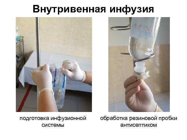 Внутривенная инфузия подготовка инфузионной системы обработка резиновой пробки антисептиком 