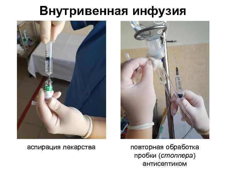 Внутривенная инфузия аспирация лекарства повторная обработка пробки (стоппера) антисептиком 