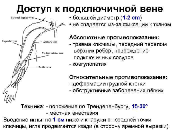 Доступ к подключичной вене • большой диаметр (1 2 cm) • не спадается из