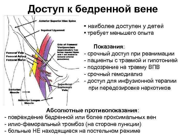 Доступ к бедренной вене • наиболее доступен у детей • требует меньшего опыта Показания: