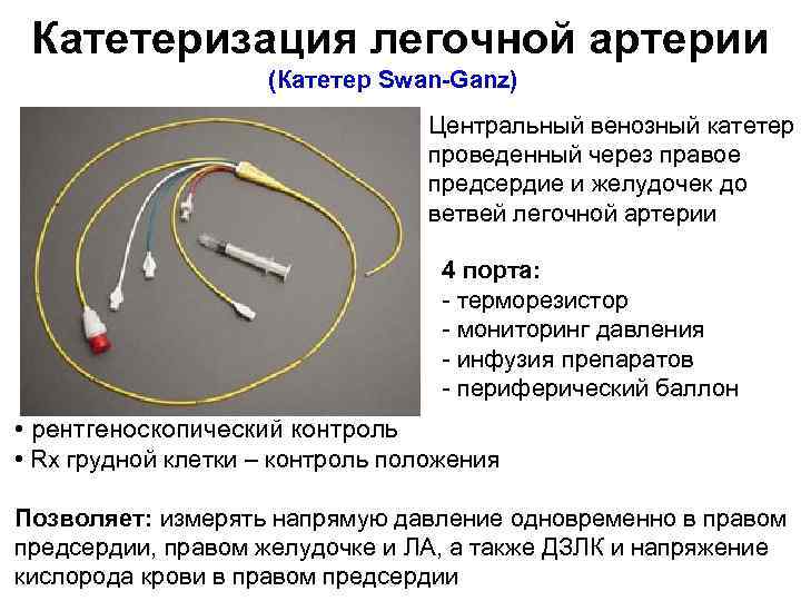 Катетеризация легочной артерии (Катетер Swan Ganz) Центральный венозный катетер проведенный через правое предсердие и