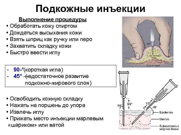 Подкожные инъекции Выполнение процедуры • Обработать кожу спиртом • Дождаться высыхания кожи • Взять