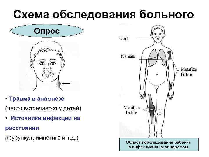 Схема обследования больного Опрос • Травма в анамнезе (часто встречается у детей) • Источники