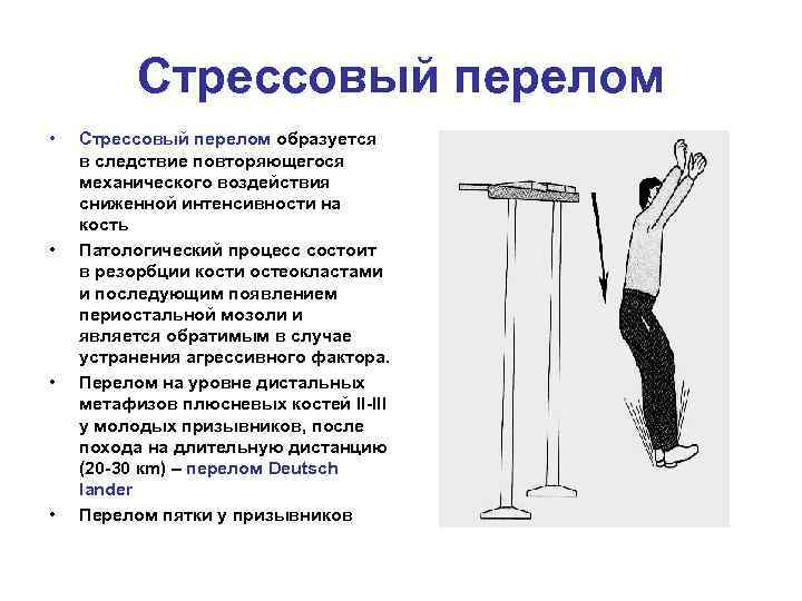 Стрессовый перелом • • Стрессовый перелом образуется в следствие повторяющегося механического воздействия сниженной интенсивности