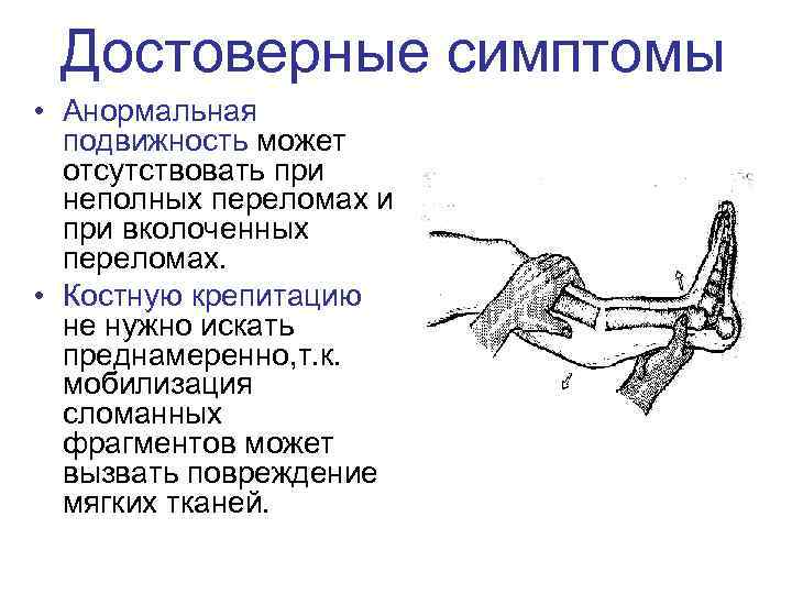 Достоверные симптомы • Анормальная подвижность может отсутствовать при неполных переломах и при вколоченных переломах.