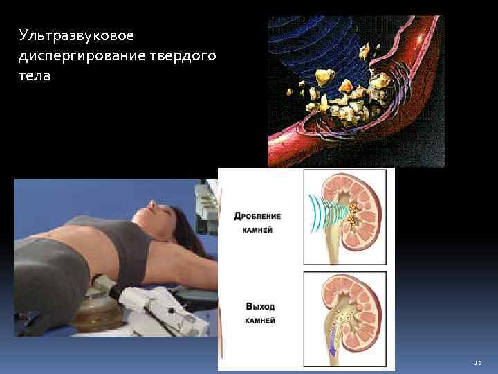 Ультразвуковое диспергирование твердого тела 12 