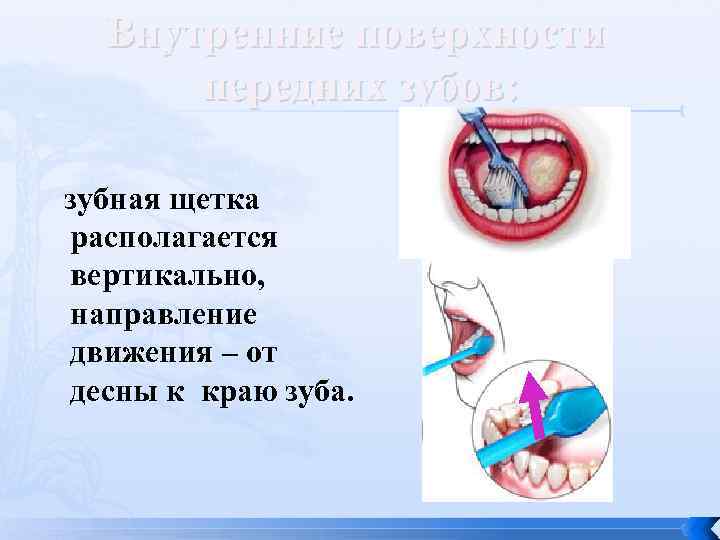 Внутренние поверхности передних зубов: зубная щетка располагается вертикально, направление движения – от десны к