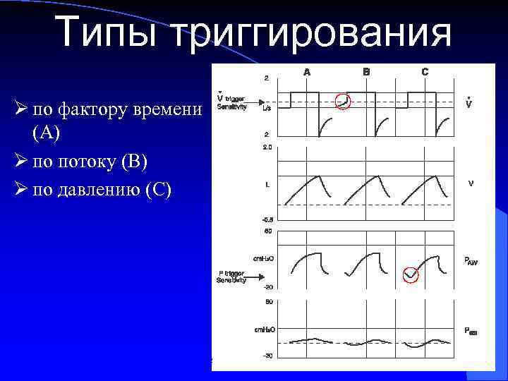 Типы триггирования Ø по фактору времени (А) Ø по потоку (В) Ø по давлению