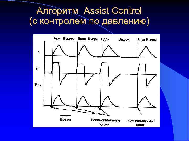 Алгоритм Assist Control (с контролем по давлению) 