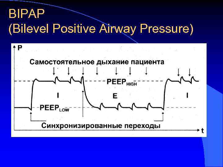 BIPAP (Bilevel Positive Airway Pressure) 