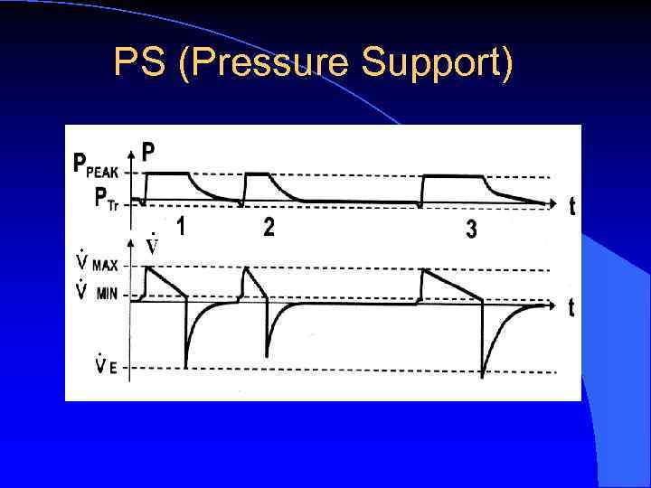 PS (Pressure Support) 