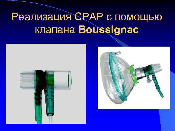 Реализация CPAP c помощью клапана Boussignac 