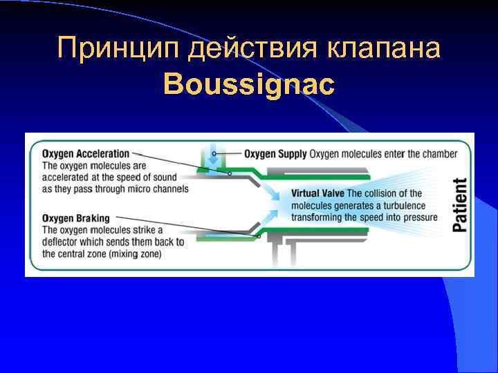 Принцип действия клапана Boussignac 