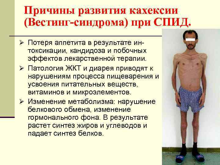 Причины развития кахексии (Вестинг-синдрома) при СПИД. Ø Потеря аппетита в результате ин- токсикации, кандидоза
