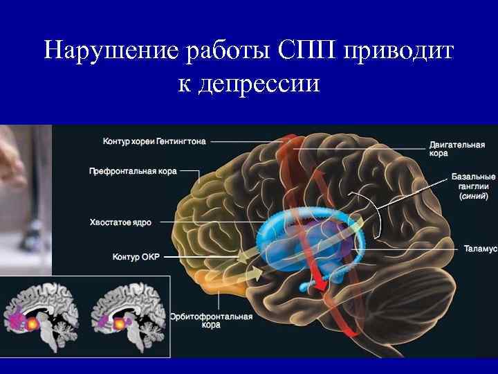 Нарушение работы СПП приводит к депрессии 