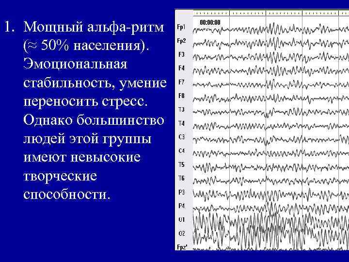 1. Мощный альфа-ритм (≈ 50% населения). Эмоциональная стабильность, умение переносить стресс. Однако большинство людей