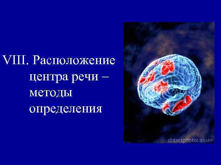 VIII. Расположение центра речи – методы определения 