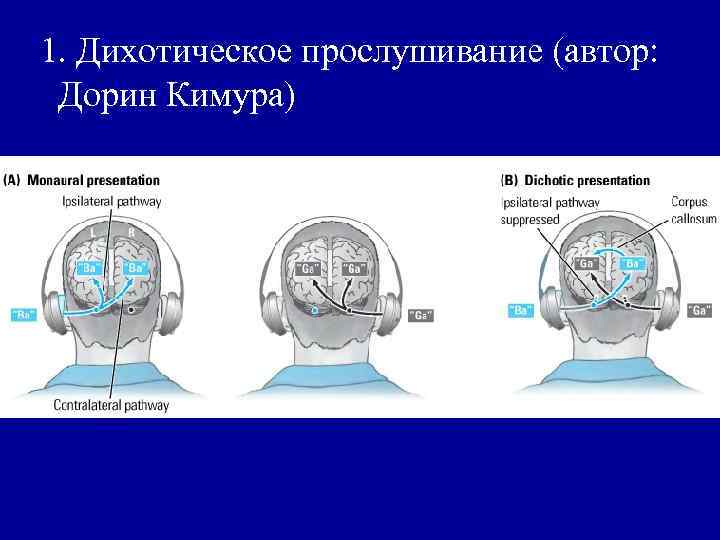 1. Дихотическое прослушивание (автор: Дорин Кимура) 