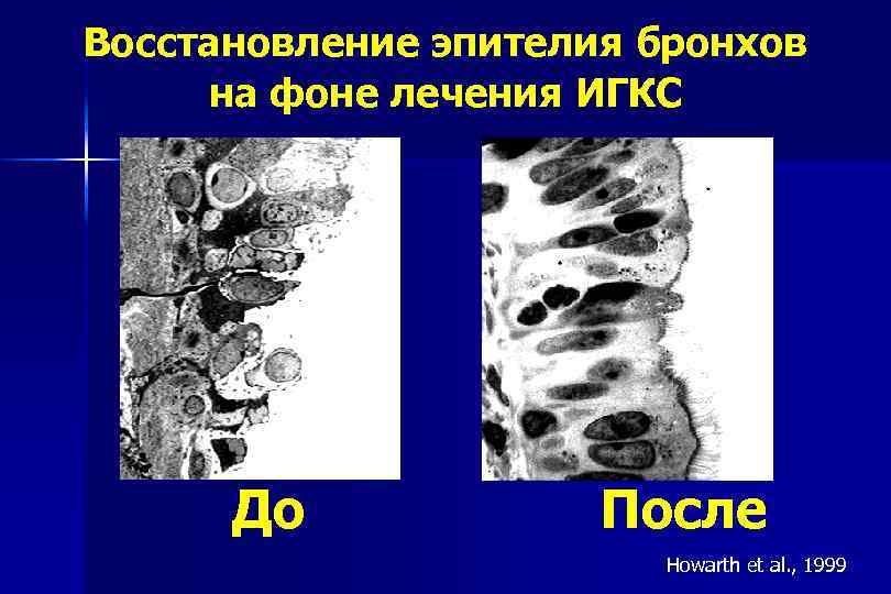 Восстановление эпителия бронхов на фоне лечения ИГКС До После Howarth et al. , 1999