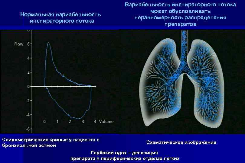 Нормальная вариабельность инспираторного потока Вариабельность инспираторного потока может обусловливать неравномерность распределения препаратов Спирометрические кривые