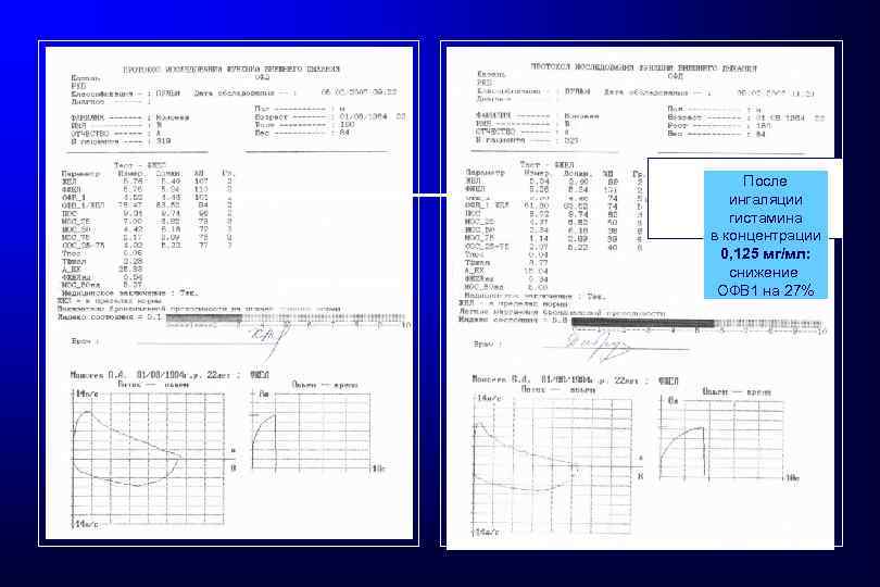 До теста с гистамином После ингаляции гистамина в концентрации 0, 125 мг/мл: снижение ОФВ
