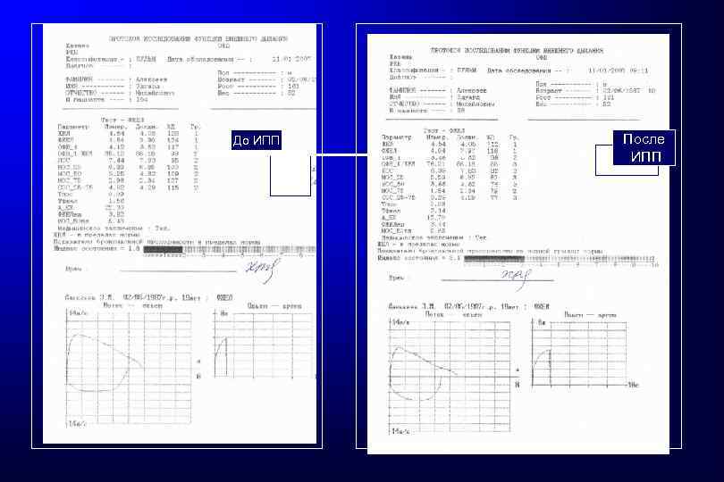 До ИПП После ИПП 