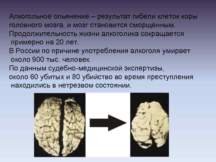 Алкогольное опьянение – результат гибели клеток коры головного мозга, и мозг становится сморщенным. Продолжительность