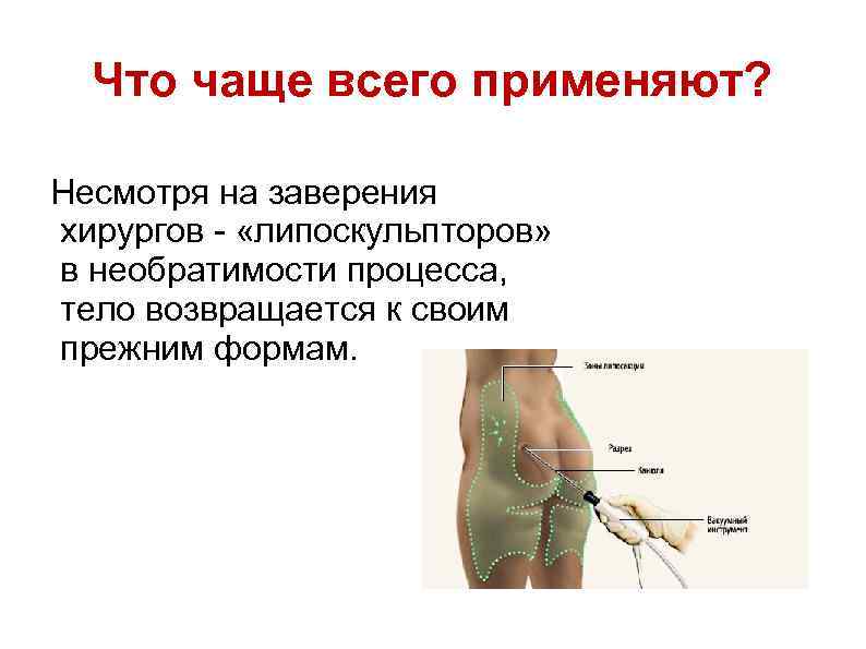 Что чаще всего применяют? Несмотря на заверения хирургов - «липоскульпторов» в необратимости процесса, тело