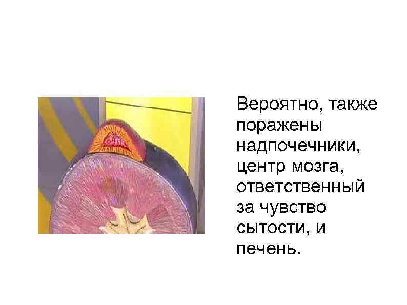 Вероятно, также поражены надпочечники, центр мозга, ответственный за чувство сытости, и печень. 