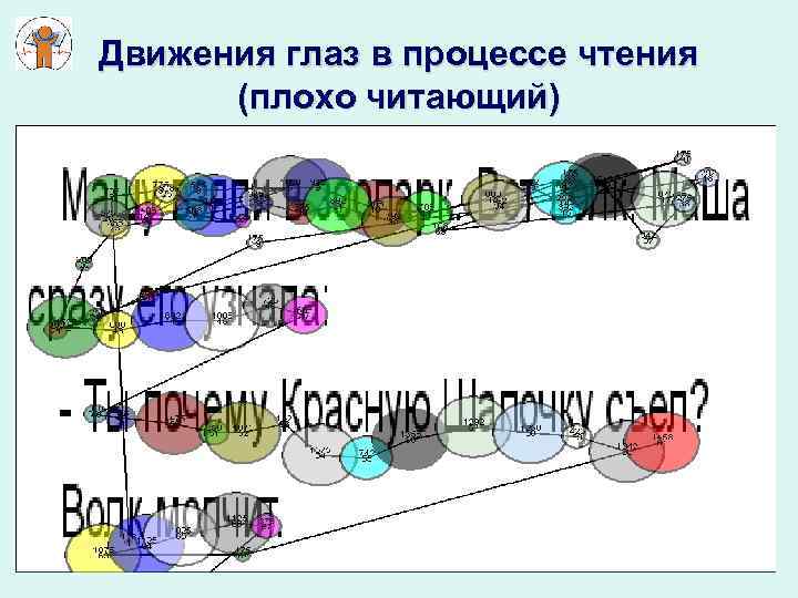 Движения глаз в процессе чтения (плохо читающий) 