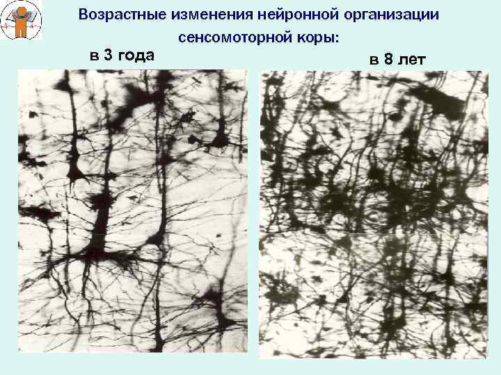 Возрастные изменения нейронной организации сенсомоторной коры: в 3 года в 8 лет 