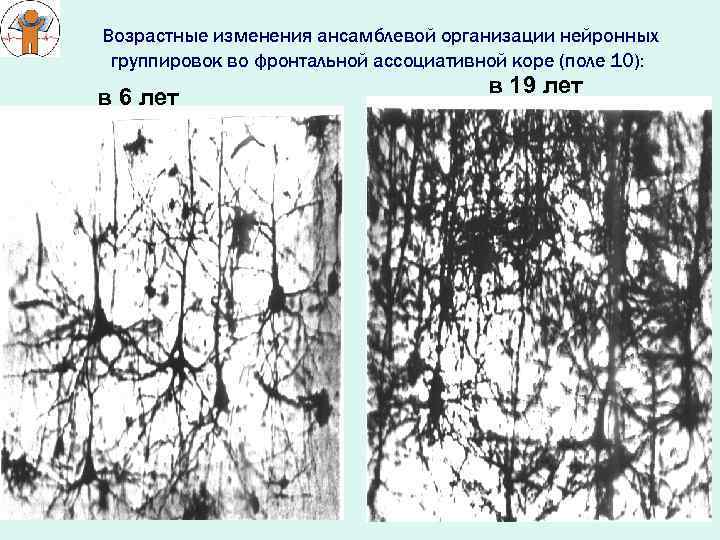 Возрастные изменения ансамблевой организации нейронных группировок во фронтальной ассоциативной коре (поле 10): в 6