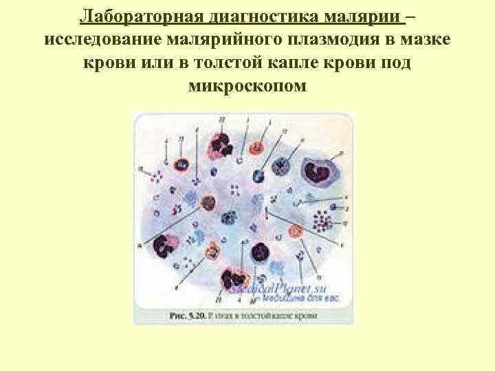 Малярийный плазмодий в толстой капле фото