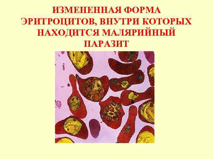 ИЗМЕНЕННАЯ ФОРМА ЭРИТРОЦИТОВ, ВНУТРИ КОТОРЫХ НАХОДИТСЯ МАЛЯРИЙНЫЙ ПАРАЗИТ 