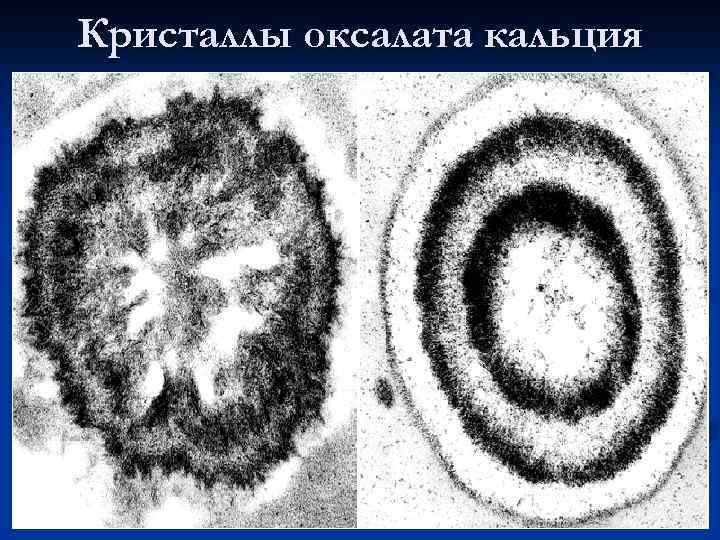 Кристаллы оксалата кальция 