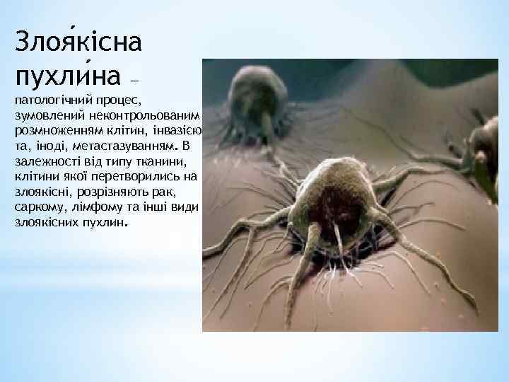 Злоя кісна пухли на — патологічний процес, зумовлений неконтрольованим розмноженням клітин, інвазією та, іноді,