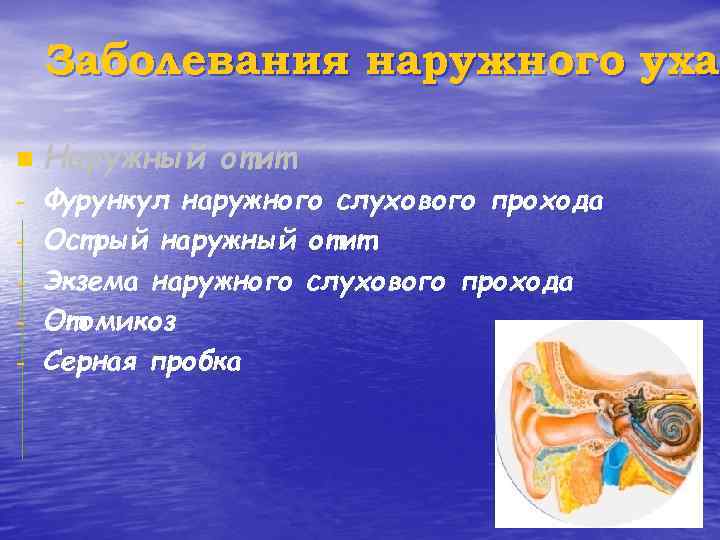 Заболевания наружного уха n - Наружный отит Фурункул наружного слухового прохода Острый наружный отит