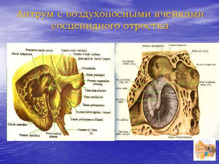 Антрум с воздухоносными ячейками сосцевидного отростка 