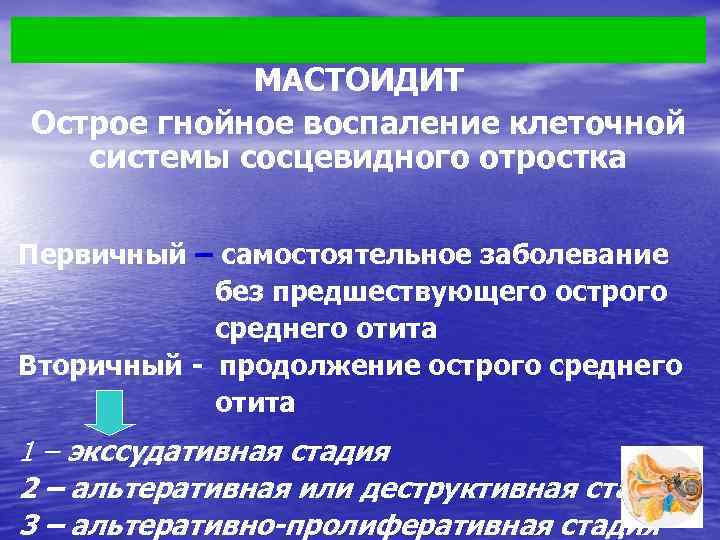 МАСТОИДИТ Острое гнойное воспаление клеточной системы сосцевидного отростка Первичный – самостоятельное заболевание без предшествующего