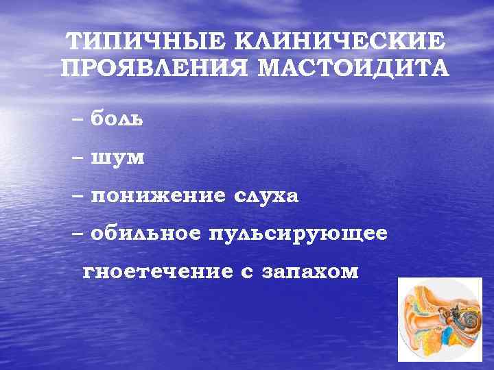 ТИПИЧНЫЕ КЛИНИЧЕСКИЕ ПРОЯВЛЕНИЯ МАСТОИДИТА – боль – шум – понижение слуха – обильное пульсирующее