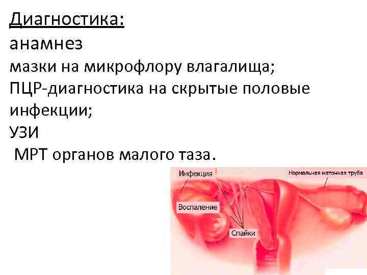 Диагностика: анамнез мазки на микрофлору влагалища; ПЦР-диагностика на скрытые половые инфекции; УЗИ МРТ органов