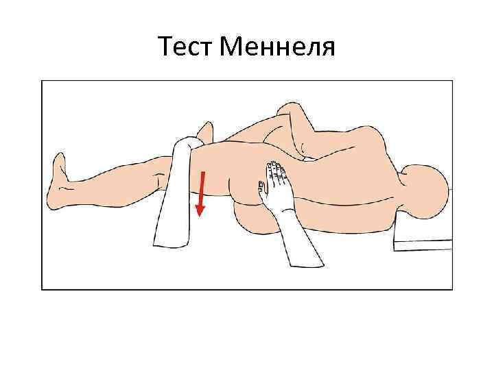 Тест Меннеля 