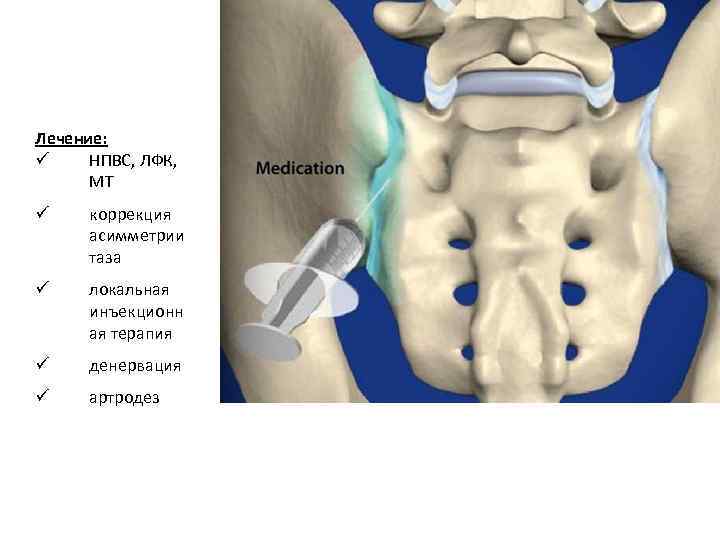 Лечение: ü НПВС, ЛФК, МТ ü коррекция асимметрии таза ü локальная инъекционн ая терапия