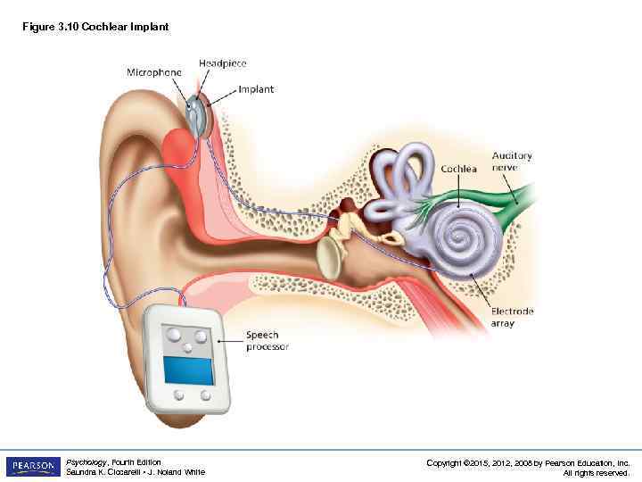 Figure 3. 10 Cochlear Implant Psychology, Fourth Edition Saundra K. Ciccarelli • J. Noland