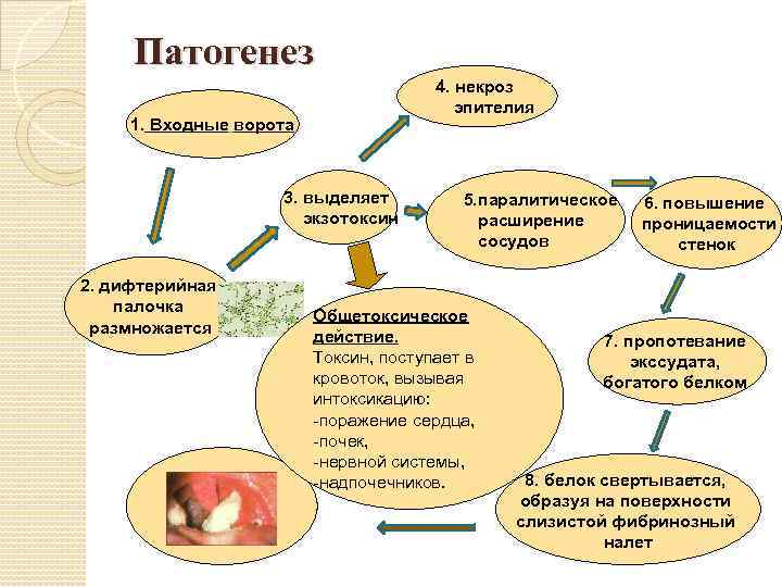 Патогенез 4. некроз эпителия 1. Входные ворота 3. выделяет экзотоксин 2. дифтерийная палочка размножается