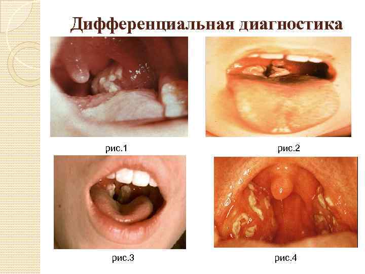 Дифференциальная диагностика рис. 1 рис. 3 рис. 2 рис. 4 