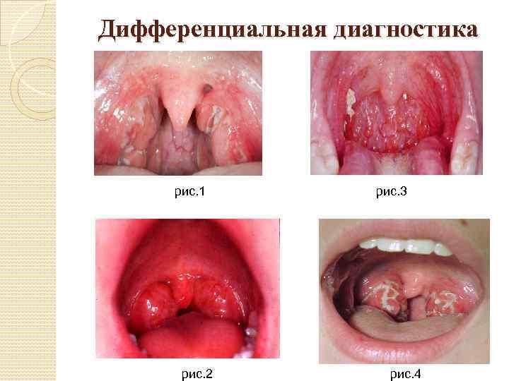 Дифференциальная диагностика рис. 1 рис. 3 рис. 2 рис. 4 